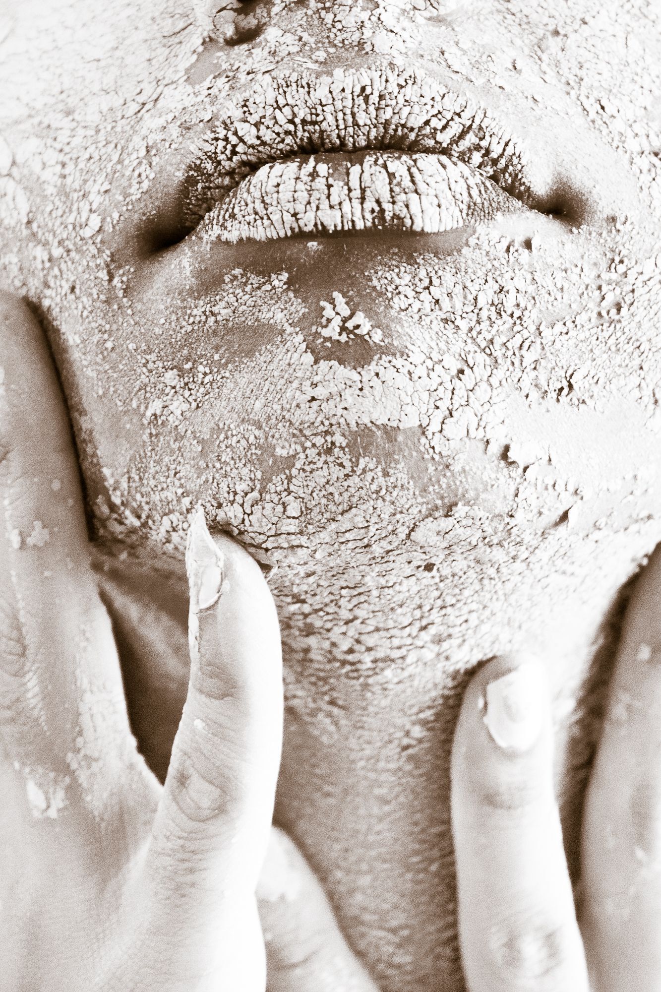 Visage à la peau très sèche et craquelée, illustrant la différence entre peau sèche et peau déshydratée